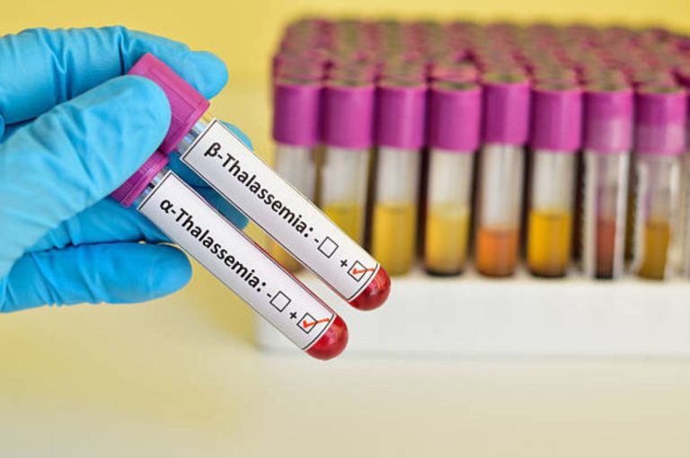 Thalassemia in West Bengal: Key Causes, Major Impact, Effective Treatment, and Proven Prevention Measures