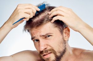 hair fall