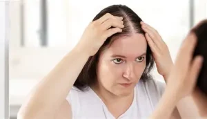 hair fall