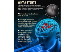 India Approves Supernova Stent Retriever