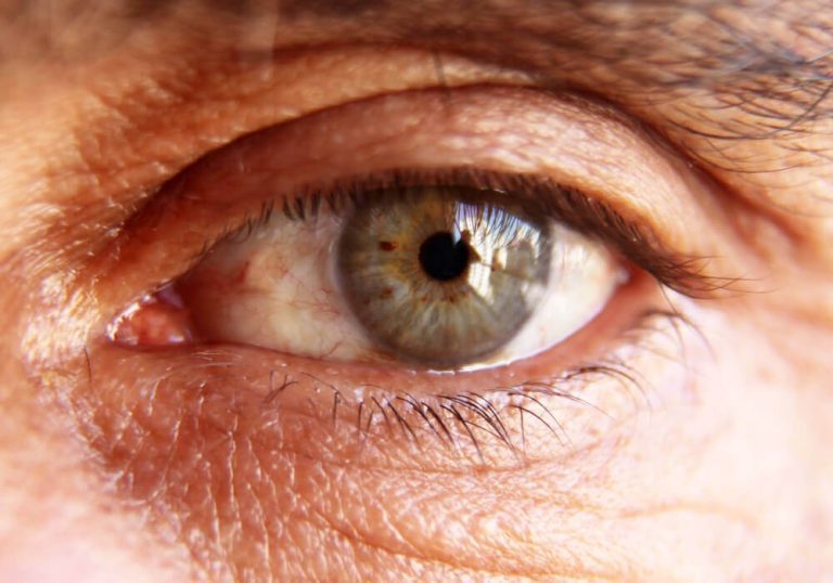 Diabetic Related Vision Loss Rising Rapidly in India as Retinopathy Cases Go Undetected in 2025
