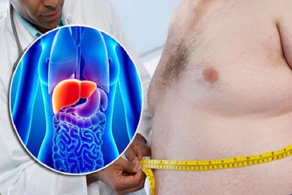 Check Fatty Liver at Home With These 5 Early Warning Signs, Say Experts