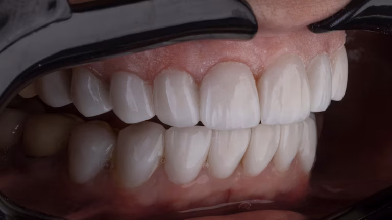 New Tooth Growth Breakthrough Could End Dental Implants by 2030