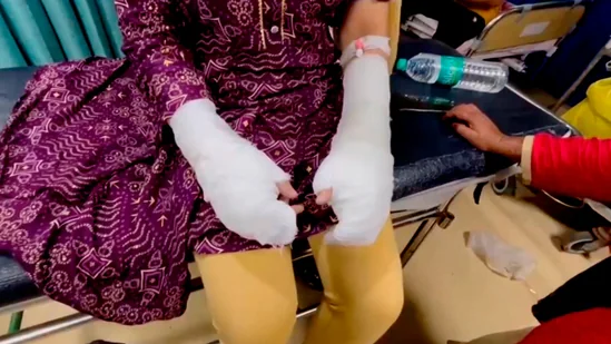 Fake Acid Attack Exposed: DU Student’s Family Staged Crime
