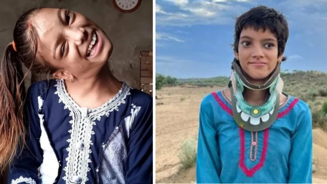 Pakistani Girl Afsheen Gul Finds a New Life After a Rare Medical Recovery