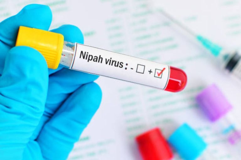 Nipah Virus Outbreak in West Bengal 2026 – Five Confirmed Cases Spark Public Health Alert and Governance Challenges Nipah Virus Outbreak in West Bengal 2026 – Five Confirmed Cases Spark Public Health Alert and Governance Challenges