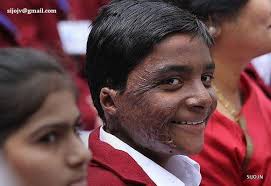 11 Years Old Saved Lives in a Fire That Changed Everything